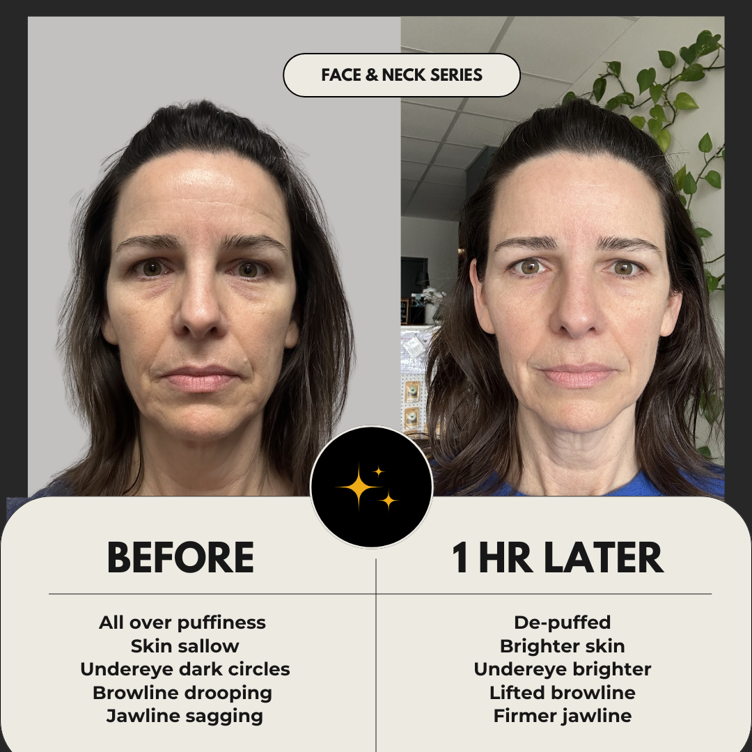 Before and after comparison of a woman's face and neck with text indicating the effects of a 'Face & Neck Class'.